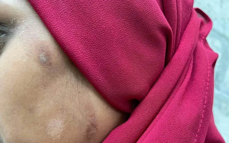 އަންހެނެއްގެ ގަޔަށް ޕެޓްރޯލް އެޅިބޮޑެތި އަނިޔާތަކެއް ލިބިއްޖެ
