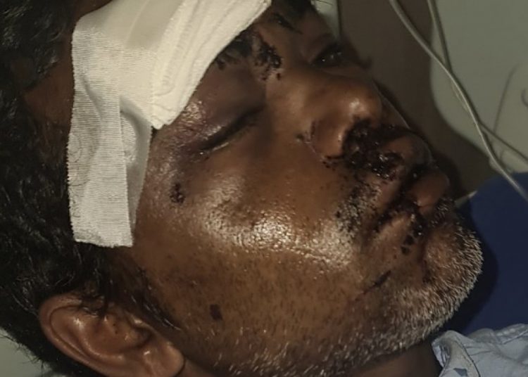 އިންޑިޔާގައި ހިނގި ނުރައްކާތެރި އެކްސިޑެންޓެއްގައި ދިވެއްސަކަށް ބޮޑެތި އަނިޔާތަކެއް