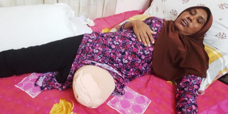 ކެންސަރު ބަލީގައި ފައި ބުރިކޮށްލުން! ފަޤީރު ދިރިއުޅުން އިތުރަށް ބަނަވެ އެހީއަށް ބޭނުންވެފައި