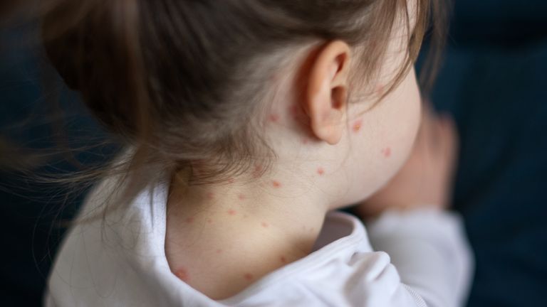 2023 ވަނަ އަހަރު ހިމަބިހީގެ ކޭސްތައް 10 މިލިއަނަށްވުރެ އިތުރުވެފައިވާކަމުގެ އިންޒާރު ޑަބްލިއުއެޗްއޯއިން ދީފި