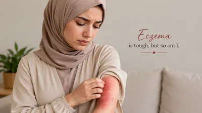 ފަތިސްތަރި: އެކްޒީމާ; ސަބަބުތައް، އަލާމާތްތައް އަދި ފަރުވާ – ހަމުގެ މި ބައްޔަށް ހޭލުންތެރިވުން މުހިންމު!