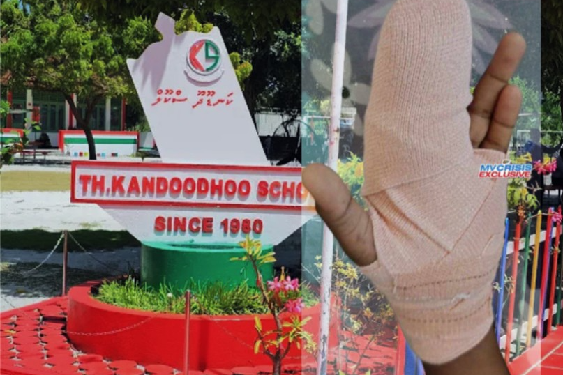 ދަރިވަރެއްގެ އިނގިލި އަނބުރައި ހުޅުން ނައްޓައިލި މައްސަލަ؛ ތުހުމަތު ކުރެވޭ ޓީޗަރު ހައްޔަރަށް!