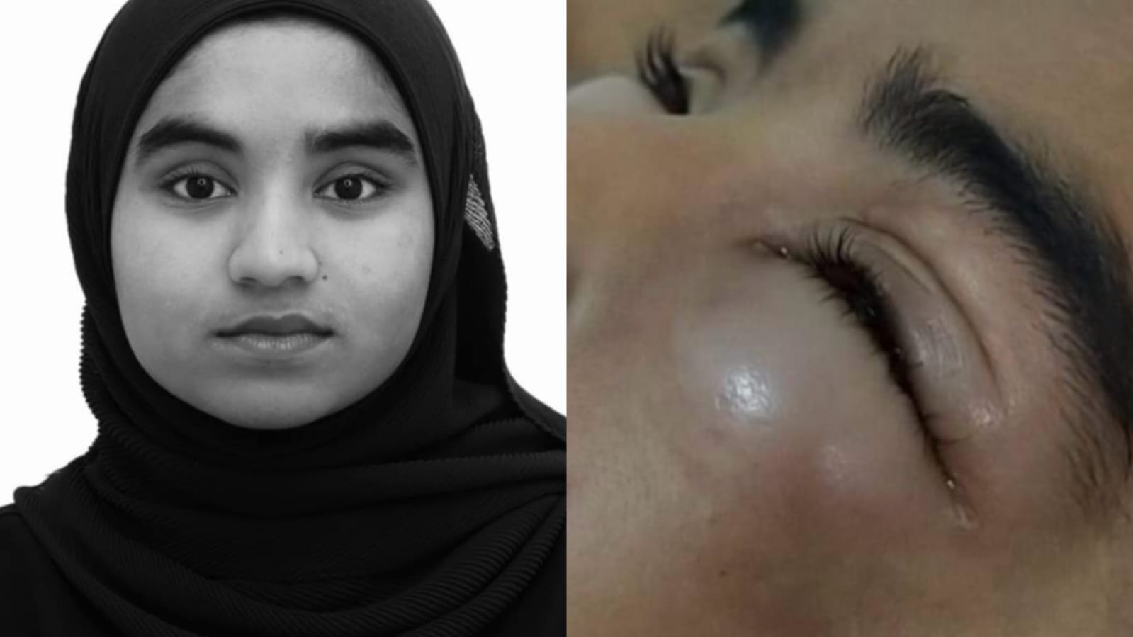 ކޮންވާޝަންޑިސްއޯޑަރ، ވޭން ތަހައްމަލު ކުރަމުންދާ 14އަހަރުގެ ޝަނީންގެ ފަރުވާއަށް އެހީވުން އެދި!